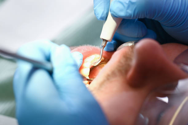 Best Broken Tooth Emergency  in Benton City, WA